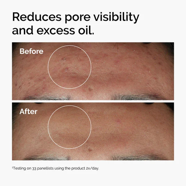 Niacinamide 10% + Zinc 1% (Copy)